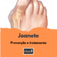 Joanete